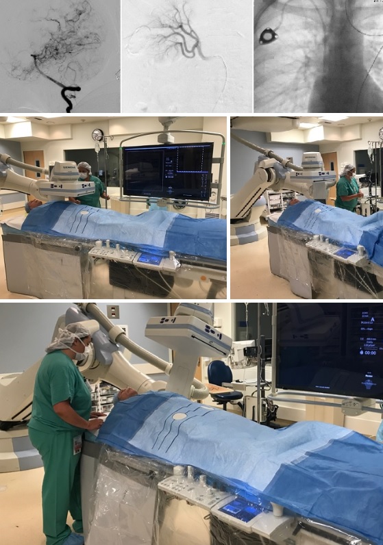 Interventional Radiology